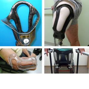 sistema de encaje HIFI